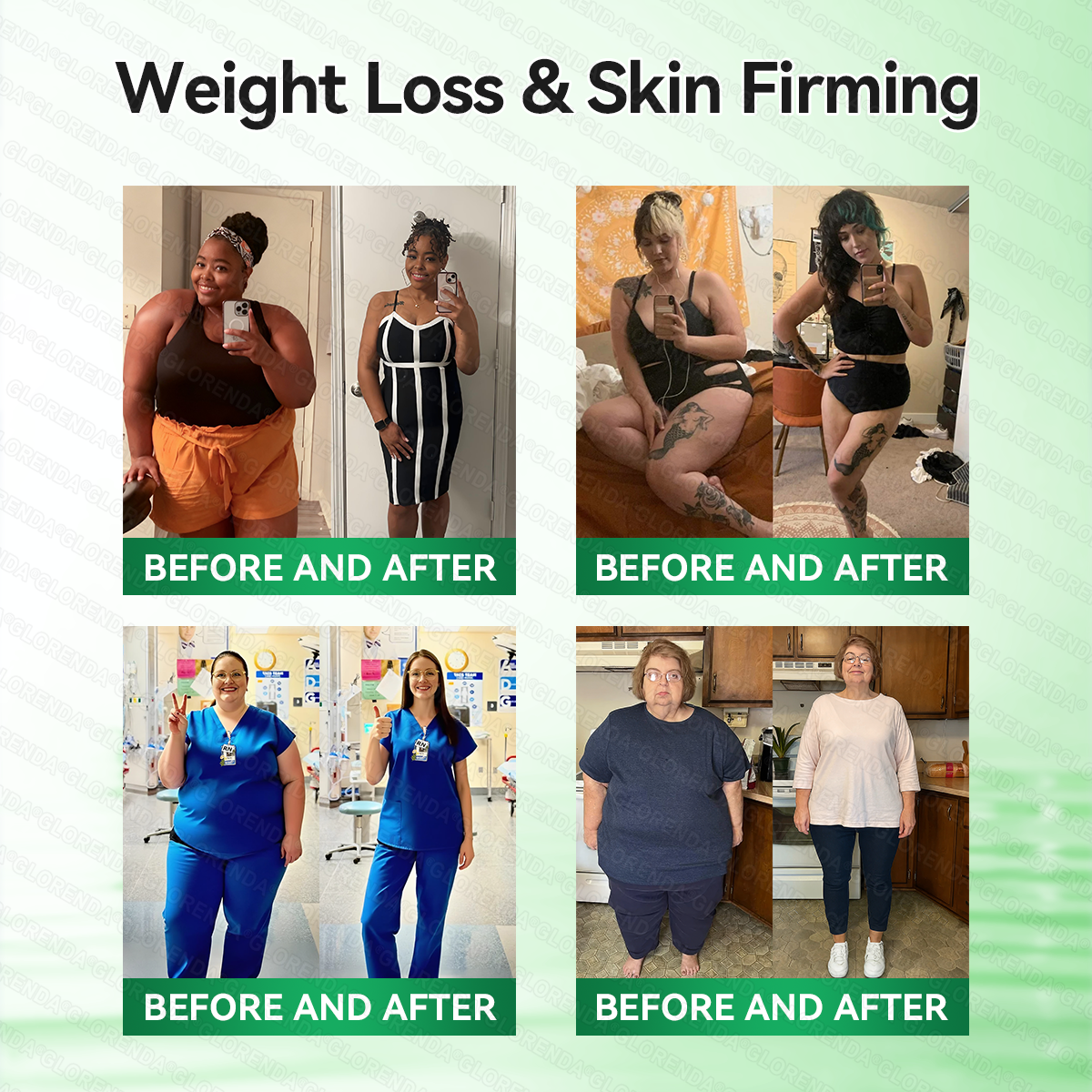 𝑶𝒇𝒇𝒊𝒄𝒊𝒂𝒍 𝑺𝒕𝒐𝒓𝒆  | 🌿𝐆𝐋𝐎𝑹𝑬𝑵𝑫𝗔®𝑴𝒐𝒓𝒊𝒏𝒈𝗮 · 𝗕𝗲𝗿𝗯𝗲𝗿𝙞𝙣𝙚 × 𝙉𝘼𝐃+ 𝟏𝟎-𝐢𝐧-𝟏 𝗔𝗱𝘃𝗮𝗻𝗰𝙚𝙙 𝙉𝙖𝙣𝙤 𝙈𝙞𝙘𝙧𝙤𝙣𝙚𝙚𝐝𝐥𝐞 𝐏𝐚𝐭𝙘𝙝🇺🇸(𝐉𝐮𝐬𝐭 𝐨𝐧𝐜𝐞 𝐚 𝐝𝐚𝐲, 𝐯𝐢𝐬𝐢𝐛𝐥𝐞 𝐜𝐡𝐚𝐧𝐠𝐞𝐬 𝐢𝐧 𝟕 𝐝𝐚𝐲𝐬） ✅ 𝐅𝐨𝐫 𝐨𝐛𝐞𝐬𝐢𝐭𝐲, 🅛🅞🅞🅢🅔 🅢🅚🅘🅝,𝐝𝐢𝐚𝐛𝐞𝐭𝐞𝐬, 𝐬𝐥𝐞𝐞𝐩 𝐚𝐩𝐧𝐞𝐚, 𝐣𝐨𝐢𝐧𝐭 𝐢𝐬𝐬𝐮𝐞𝐬, 𝐚𝐧𝐝 𝐦𝐨𝐫𝐞